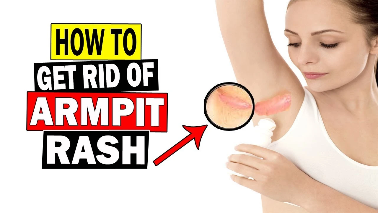 How do you get rid of armpit rash naturally