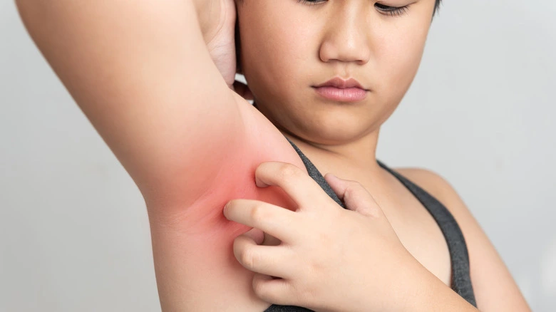 When should I be worried about armpit rash?Explanation in 3+ Way