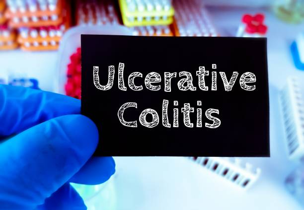 Ulcerative Colitis: Navigating the Brilliant Path to Wellness in 1 month